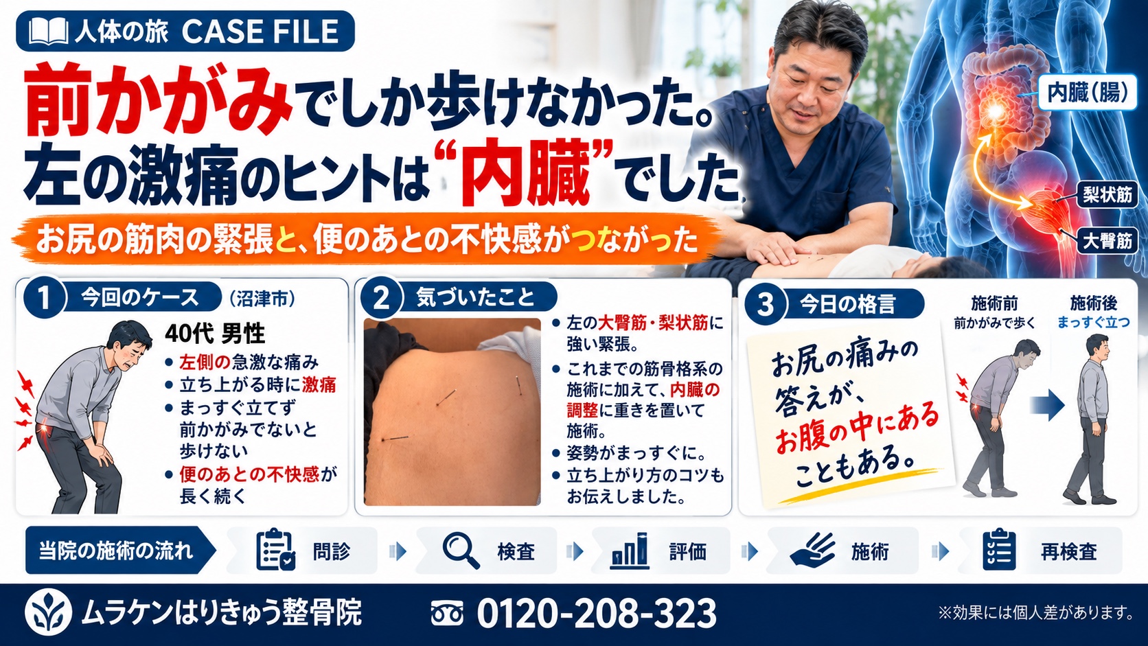 前かがみでしか歩けなかった。左の激痛のヒントは内臓でした